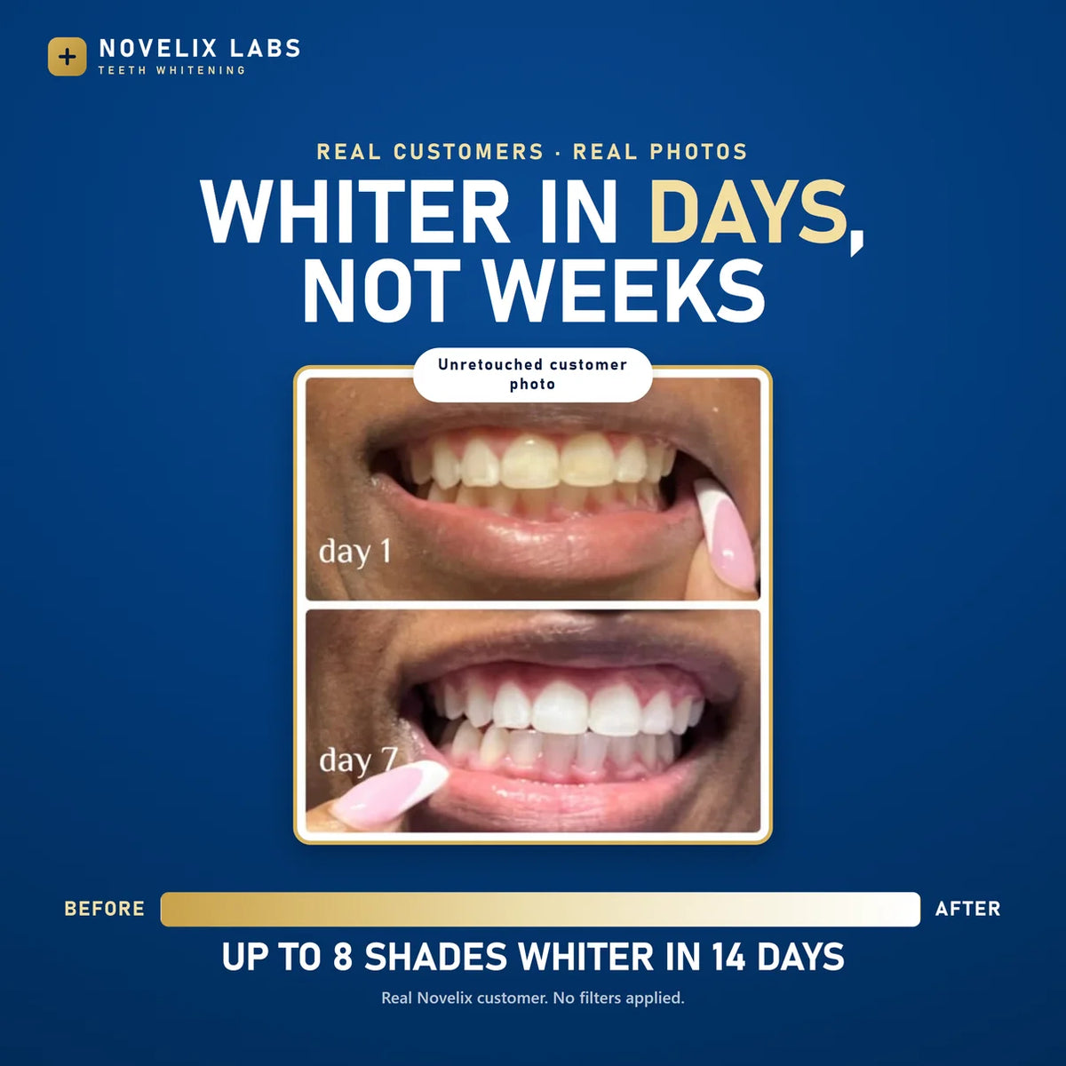 Whiter Teeth in Minutes Novelix™ Gold Pen