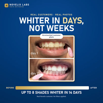 Whiter Teeth in Minutes Novelix™ Gold Pen